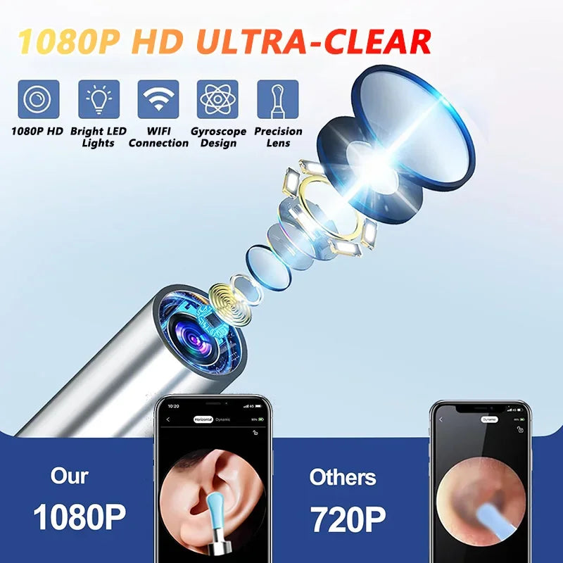 جهاز تنظيف شمع الأذن المرئي المزود بكاميرا Visual Ear Wax Cleaner with Camera