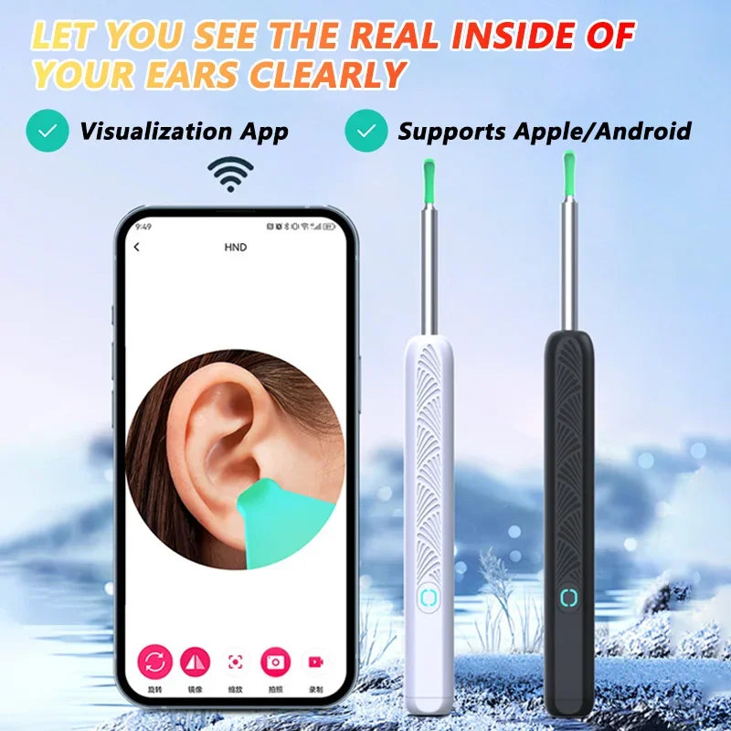 جهاز تنظيف شمع الأذن المرئي المزود بكاميرا Visual Ear Wax Cleaner with Camera